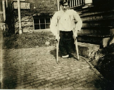 A 14 year old lad whose legs were cut off in an accident in the mine.