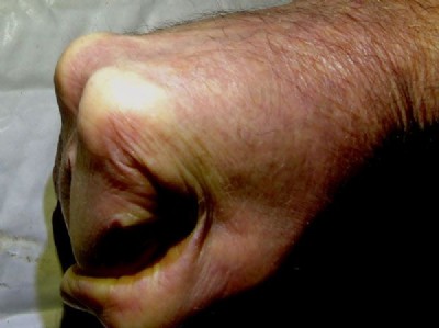 The Hand of Roy